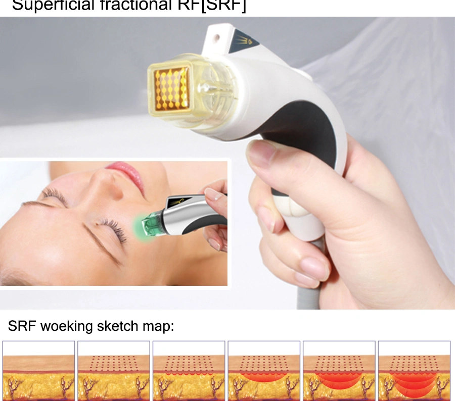 Srf+PDT Microneedle & Superficial Fractional Radio Frequency Tighten Skin Beauty Machine (MR20-1SP)