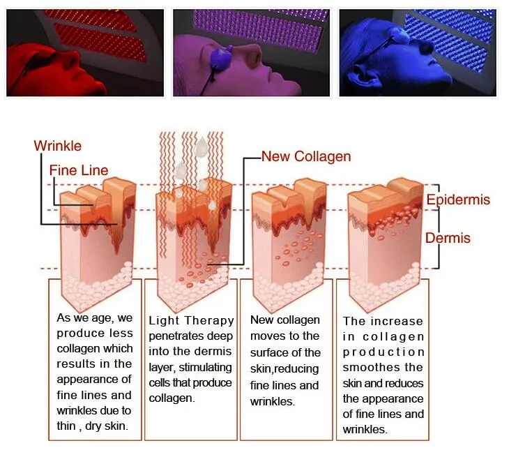 Professional LED PDT Red Blue LED Infrared Light Therapy Equipment