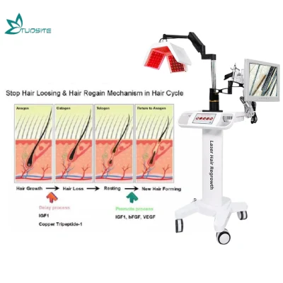 탈모 치료를 위한 전문 다이오드 레이저 모발 재성장 기계